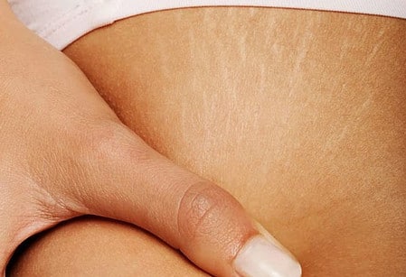 почти незаметны новые стрии