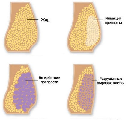 Избыточный вес вес