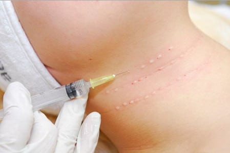 Количество иньекций иньекции