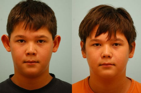 до и после операции результаты операции