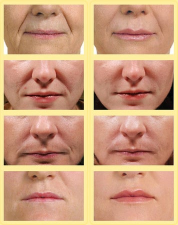 до и после до и после