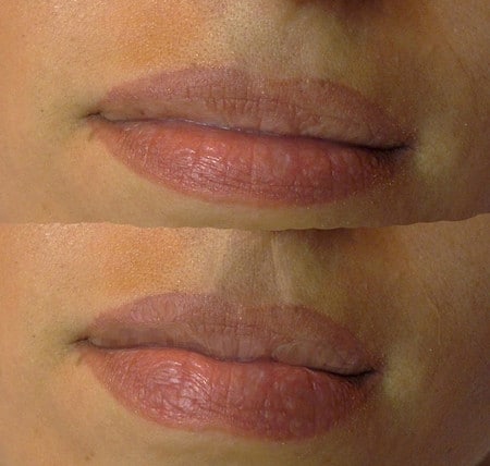 До и после результат