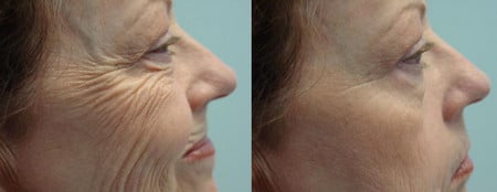 Используйте возможность сделать вашу кожу эластичной и упругой как омолодить кожу