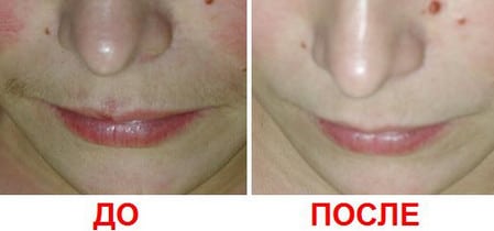 до и после сеанса