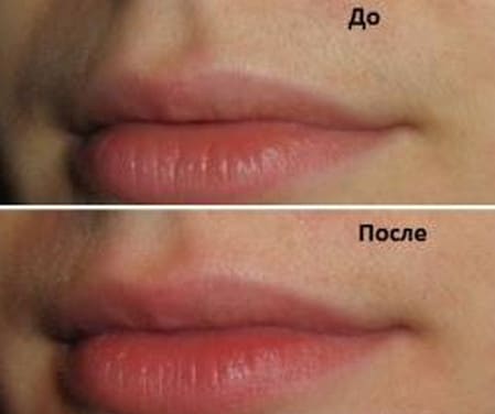 Моментальный эффект эффект