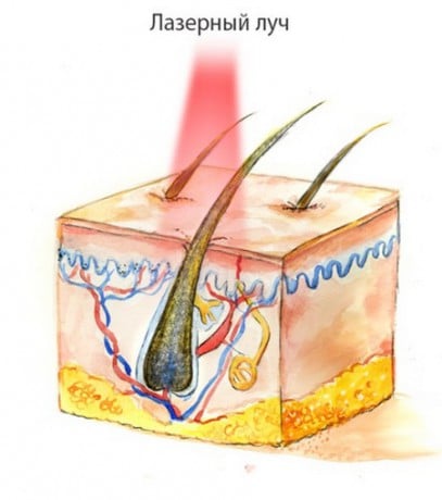 Лазерный луч луч