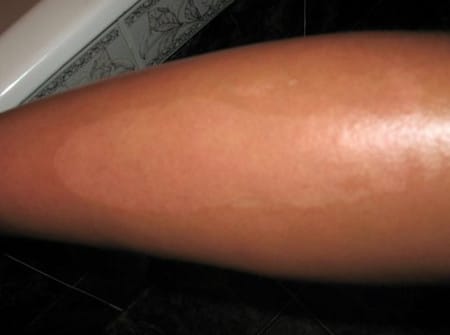 Удаление полосок удаление