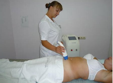 термолифтинг процес лечения