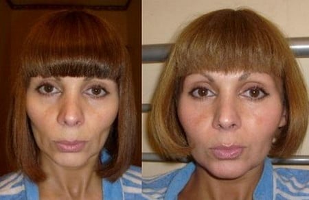 Внешний эффект результат