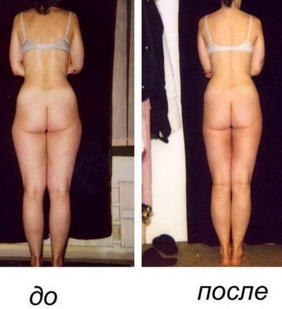 «галифе» «ушки» на бедрах