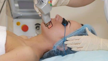 Любые процедуры с применением лазера проводятся квалифицированным специалистом проведение омоложения