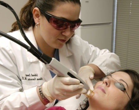 фракционный лазер