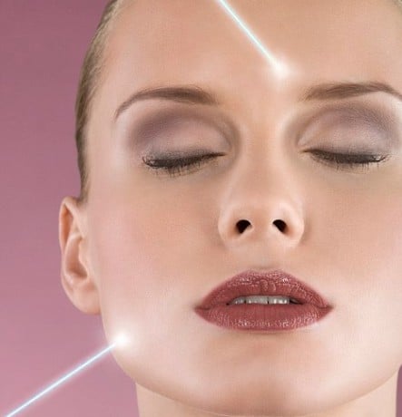 Лазерный пилинг омолодит вашу кожу эффект омоложения
