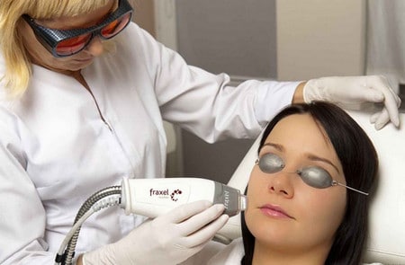 Процедура фракционного омоложения фракционное омоложение