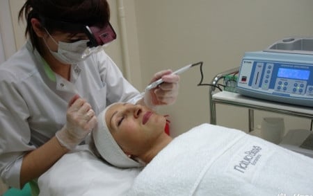 Электроэпиляция удаление волос