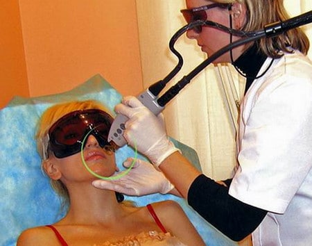 Аппаратные методы эпиляции стойкий эффект