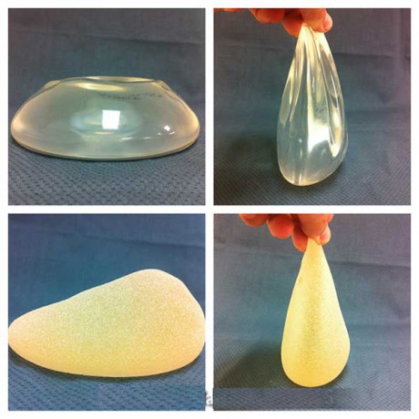 Силиконовый имплантат как выбрать имплантант