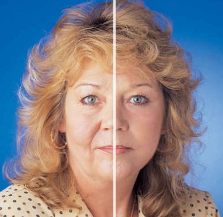 Со временем кожа теряет влагу, на ее состояние влияет солнечное излучение и гормоны состояние кожи