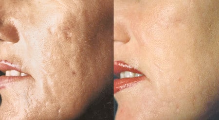 видимые повреждения кожи