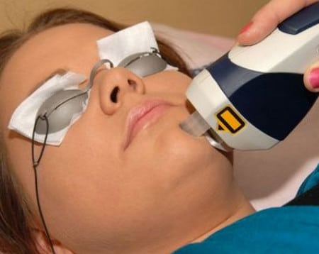 щадящий пилинг