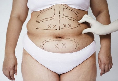 Кавитация помогает избавиться за одну процедуру от 2 до 4 см в объеме результат кавитации