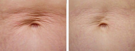 ваш живот преобразится фото до и после