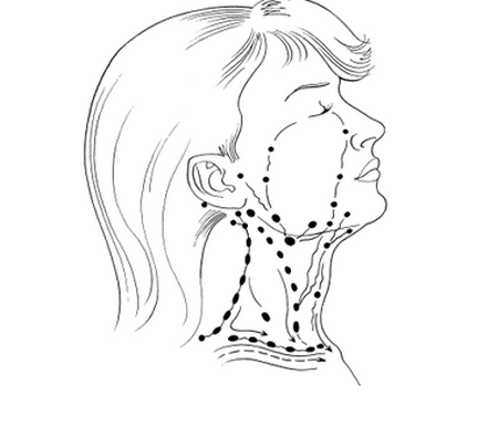 Расположения лимфоузлов лимфоузлы