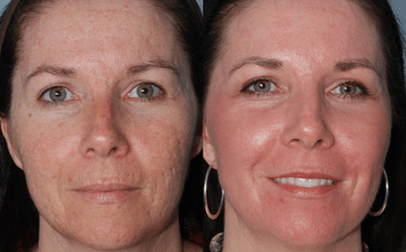 Эффект от массажа массаж