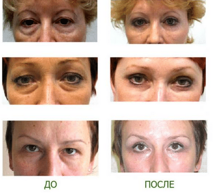 результат систематического массажа массаж