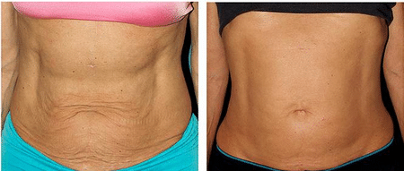 Возрастные изменения изменения