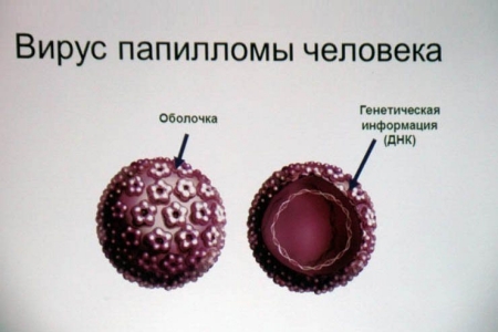 Вирус папилломы человека Вирус папилломы человека