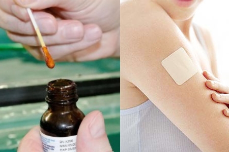 Первые меры при повреждении папилломы Первые меры при повреждении папилломы