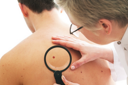 Обращение к врачу при обнаружении папилломы Обращение к врачу при обнаружении папилломы