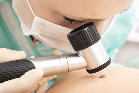 Возможность лечения папиллом Возможность лечения папиллом