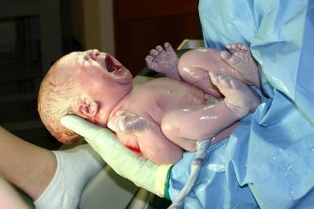 Опасность заражения ВПЧ при рождении Опасность заражения ВПЧ при рождении