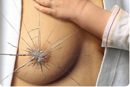 Травмирование сосков - возможная причина образования папилломы Травмирование сосков - возможная причина образования папилломы