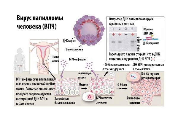 Вирус папилломы человека Вирус папилломы человека