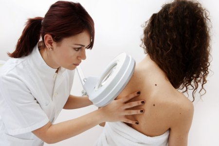 Удаление папиллом под наблюдением врача Удаление папиллом под наблюдением врача