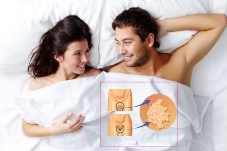 Заражение ВПЧ при контактах Заражение ВПЧ при контактах