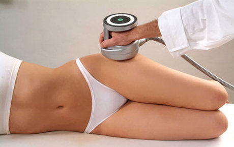 Безоперационная липосакция: отзывы пациентов