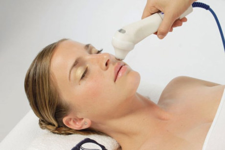 Отзыв о процедуре RF лифтинга