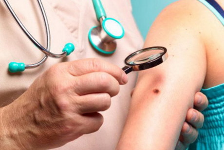 Кожные новообразования, находящиеся в предраковом состоянии