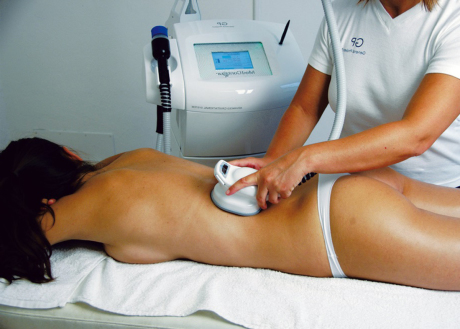 Липосакция безоперационным методом