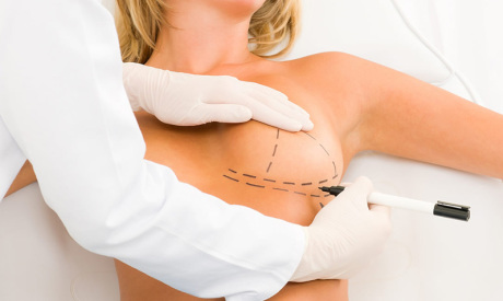 Редукционная маммопластика