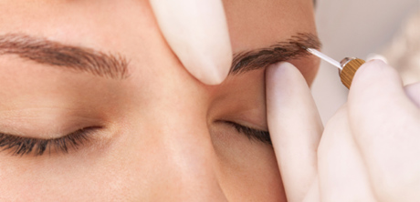 Пересадка бровей