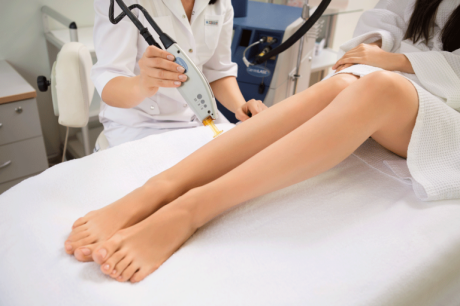 Лазерная эпиляция