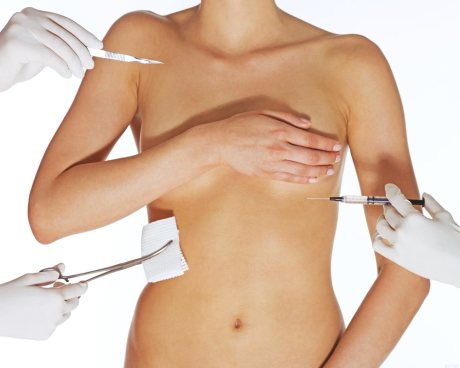 Особенности реэндопротезирования при замене или удалении грудных имплантов