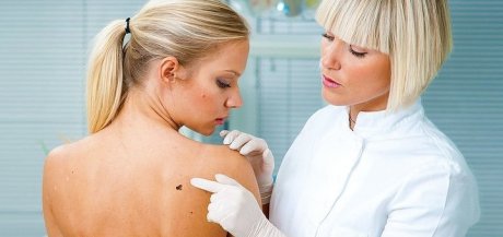 Новообразования кожи с доброкачественным характером клеток Новообразования кожи с доброкачественным характером клеток