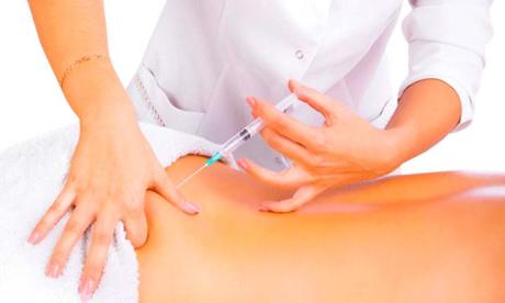 Липосакция инъекционными методами