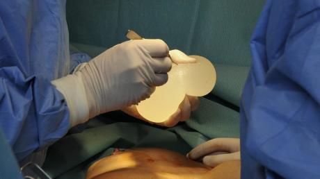 Механизм проведения операции по реэндопротезированию